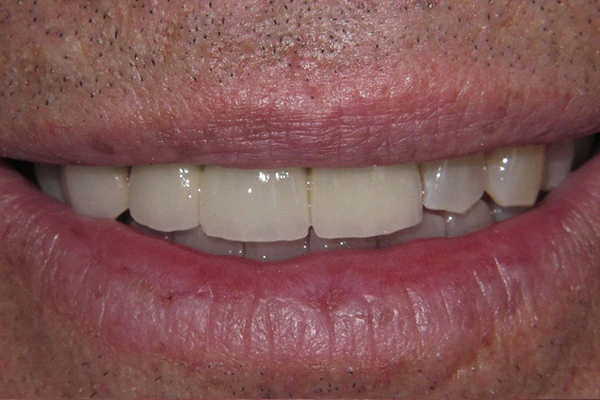 After image