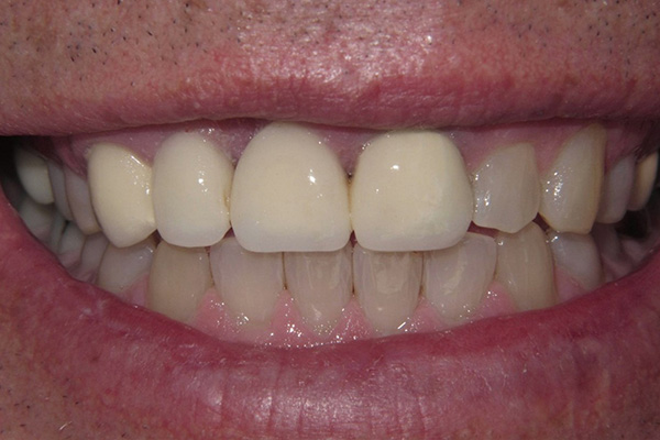 Before image
