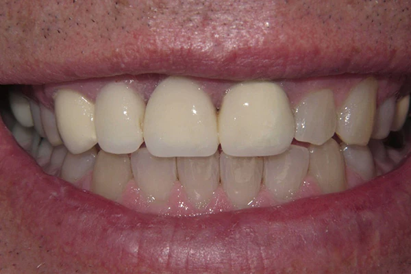 Before image