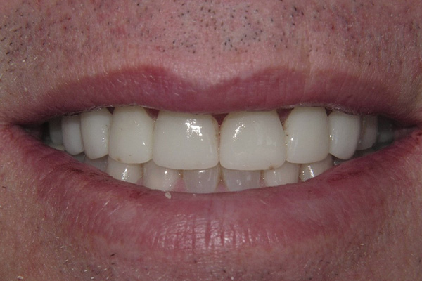After image