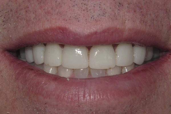 After image