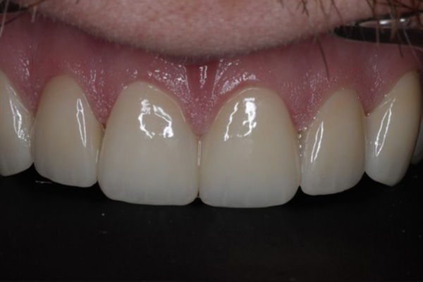 After image