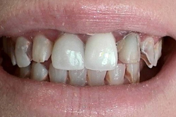 Before image