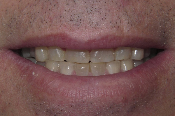 Before image
