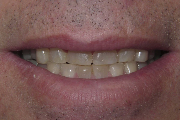 Before image