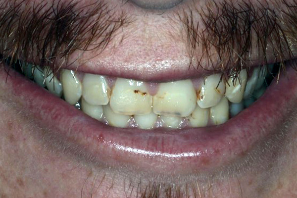 Before image