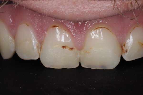 Before image
