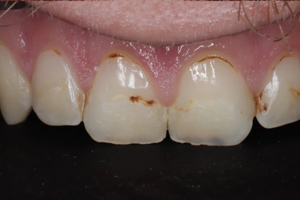 Before image