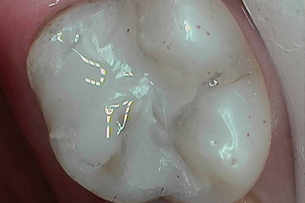 After image