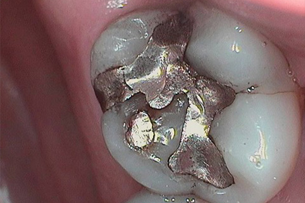Before image