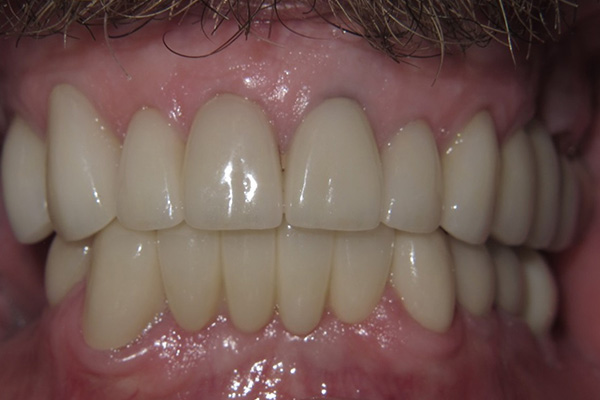 After image