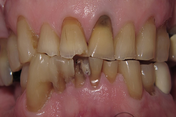 Before image