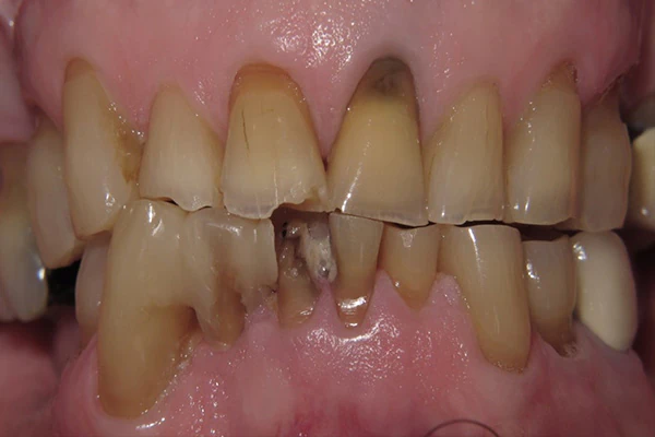 Before image