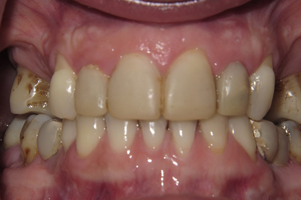 Before image