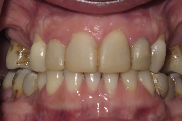 Before image