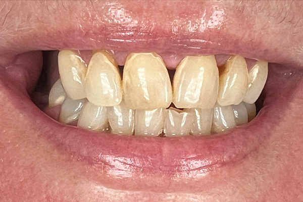Before image