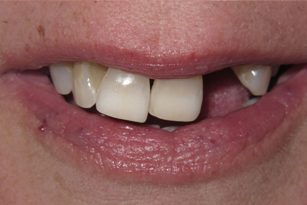 Before image