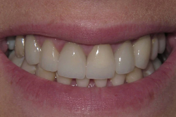 After image