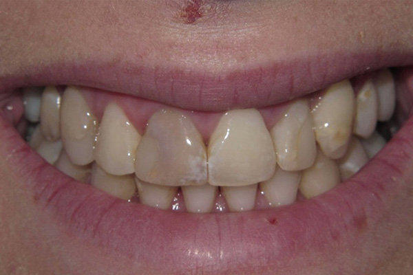 Before image