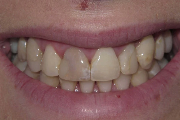 Before image