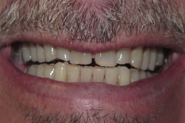 Before image