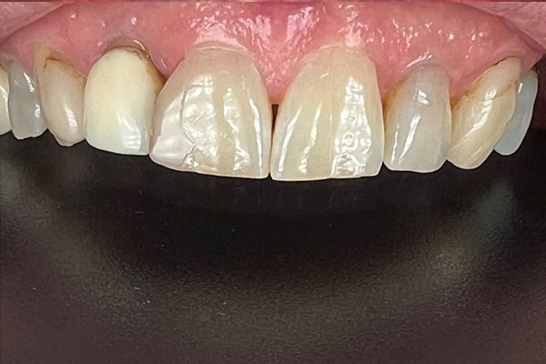 Before image