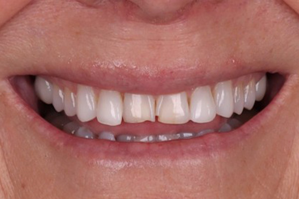 Before image
