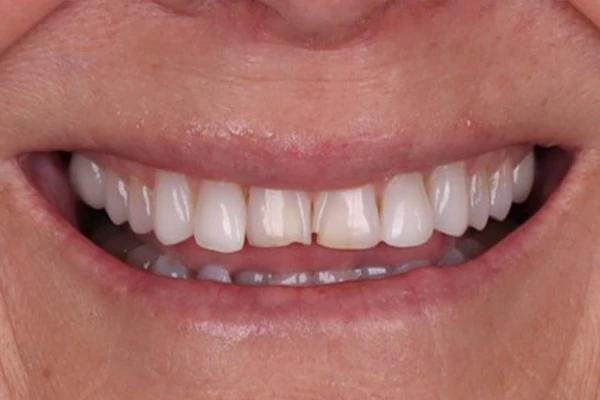 Before image