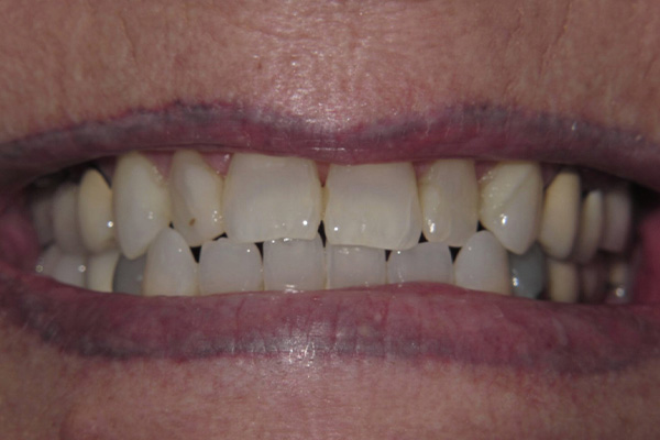 Before image