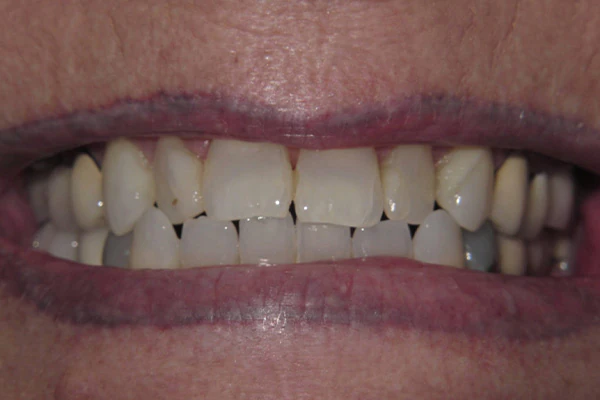 Before image