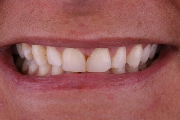 Before image