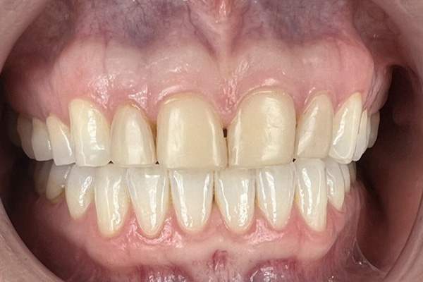 Before image