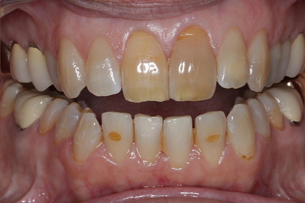 Before image